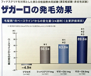 ザガーロの発毛効果