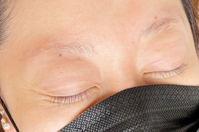 医療アートメイク 施術前