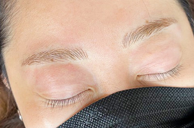 医療アートメイク 施術後