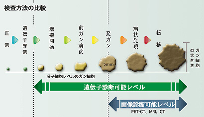検査方法の比較